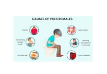 What are Piles Causes? Piles are a prevalent condition that can result in pain, itching, bleeding, and discomfort, particularly during bowel movements.
